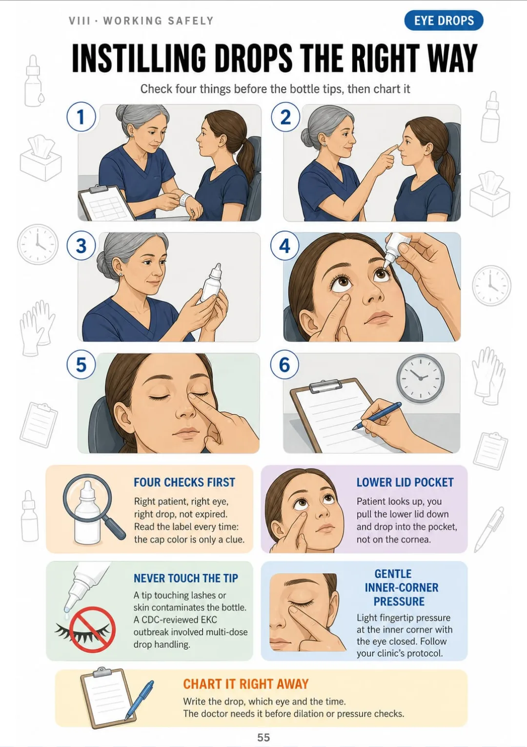 Right patient, right eye, right drop, not expired: then the lid pocket and the time on the chart.