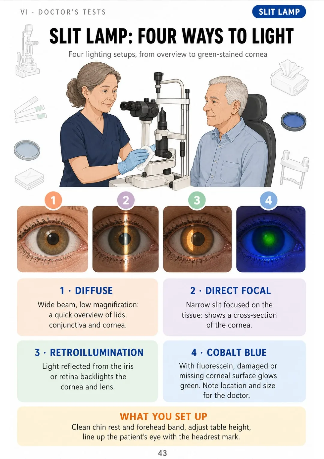 Diffuse, direct focal, retroillumination and cobalt blue: one picture each.