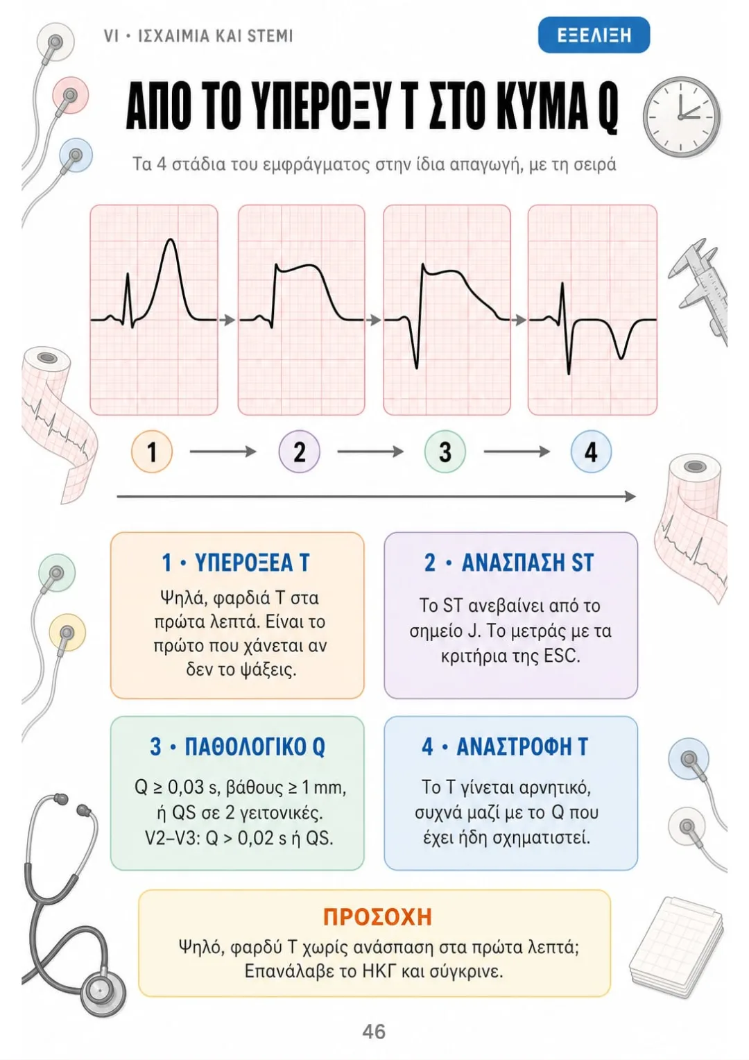 Υπεροξύ T → ανάσπαση ST → παθολογικό Q → αρνητικό T, στην ίδια απαγωγή