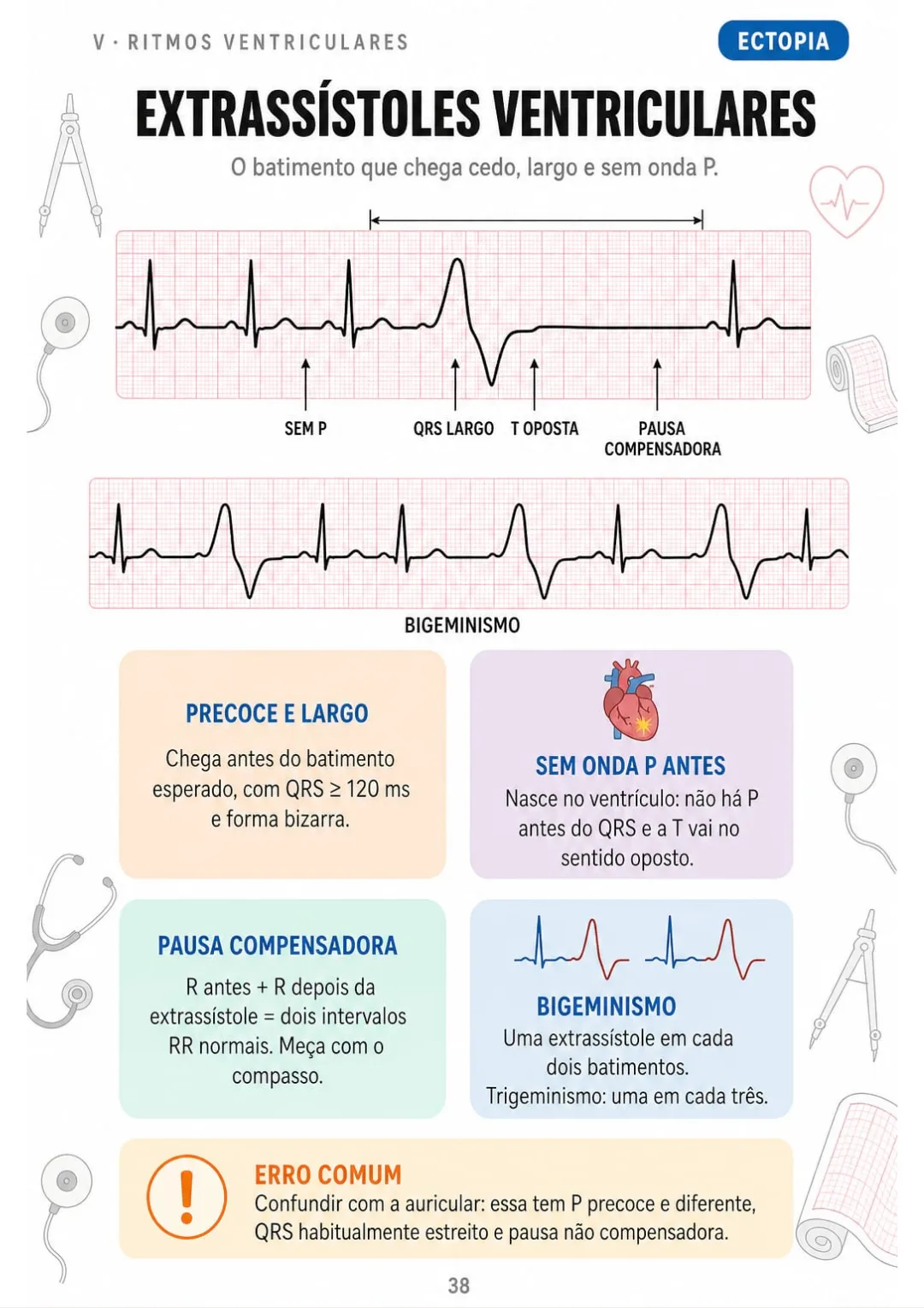 Extrassístole ventricular: QRS precoce e largo, sem P, T oposta e pausa compensadora.