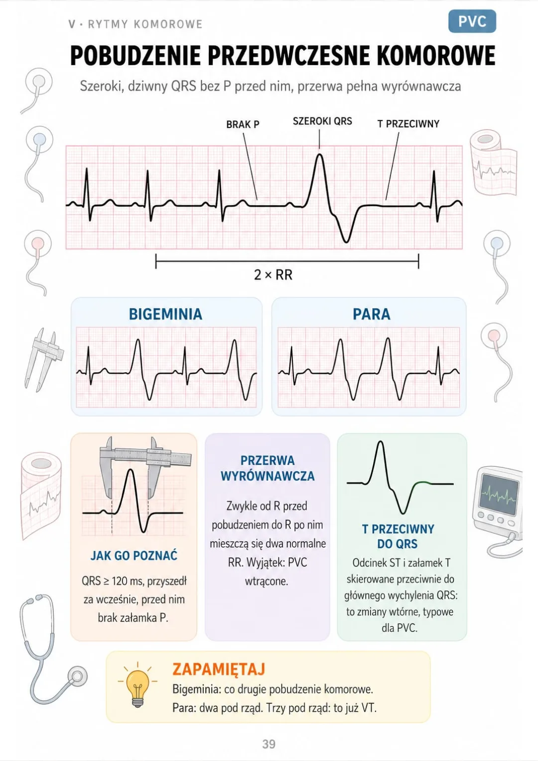 QRS ≥ 120 ms bez P, T przeciwny do QRS, R–R wokół PVC = dwa normalne RR