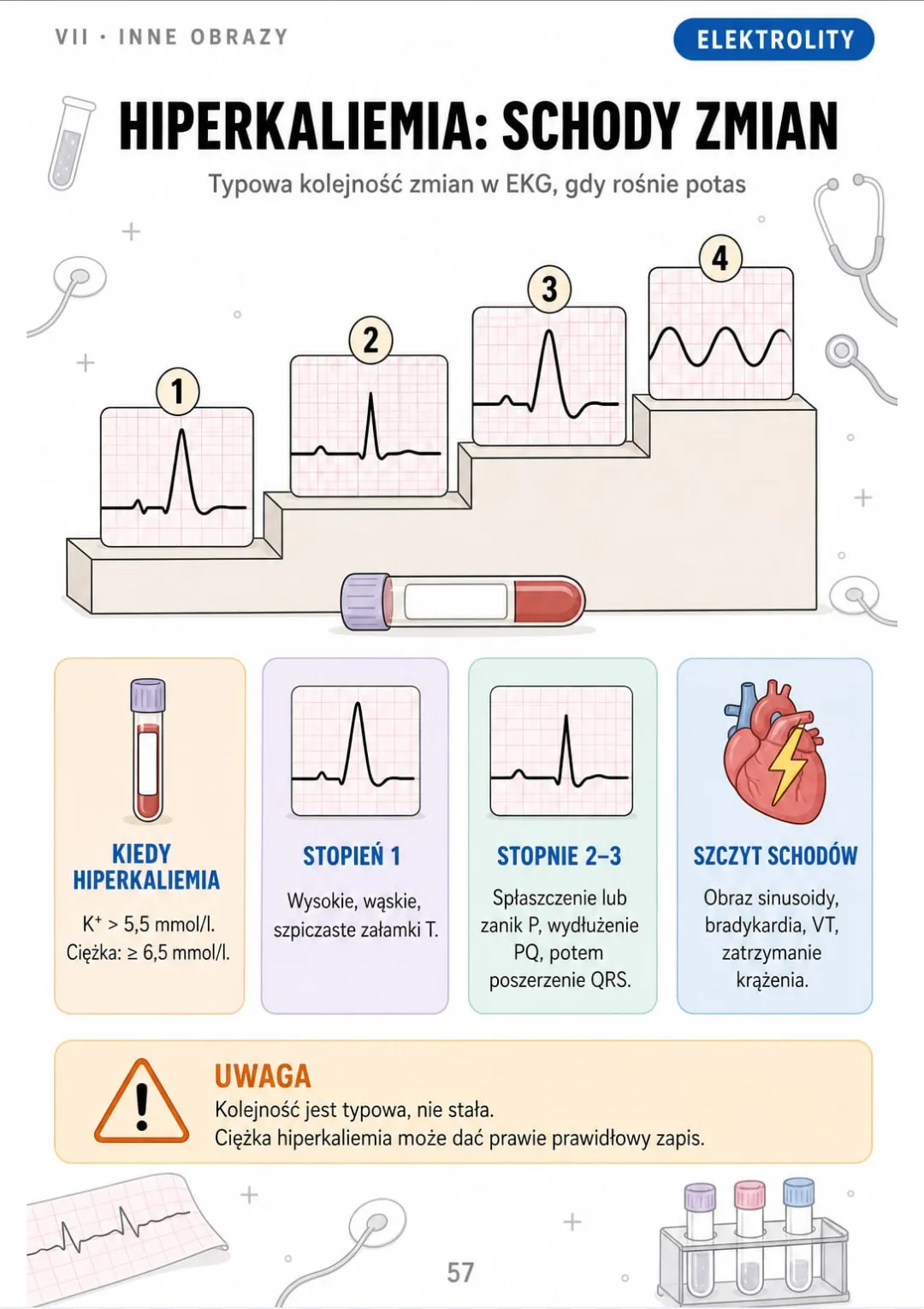 K⁺ > 5,5 mmol/l: szpiczaste T → płaskie P i długi PQ → szeroki QRS → sinusoida