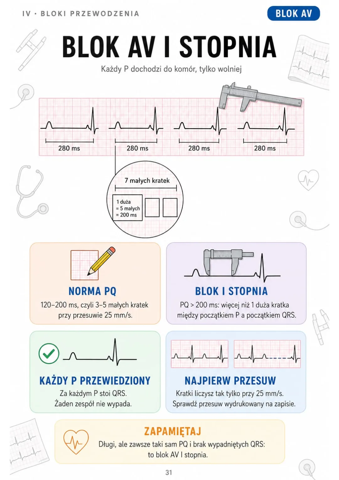 Blok AV I stopnia: PQ > 200 ms, każdy P ma swój QRS