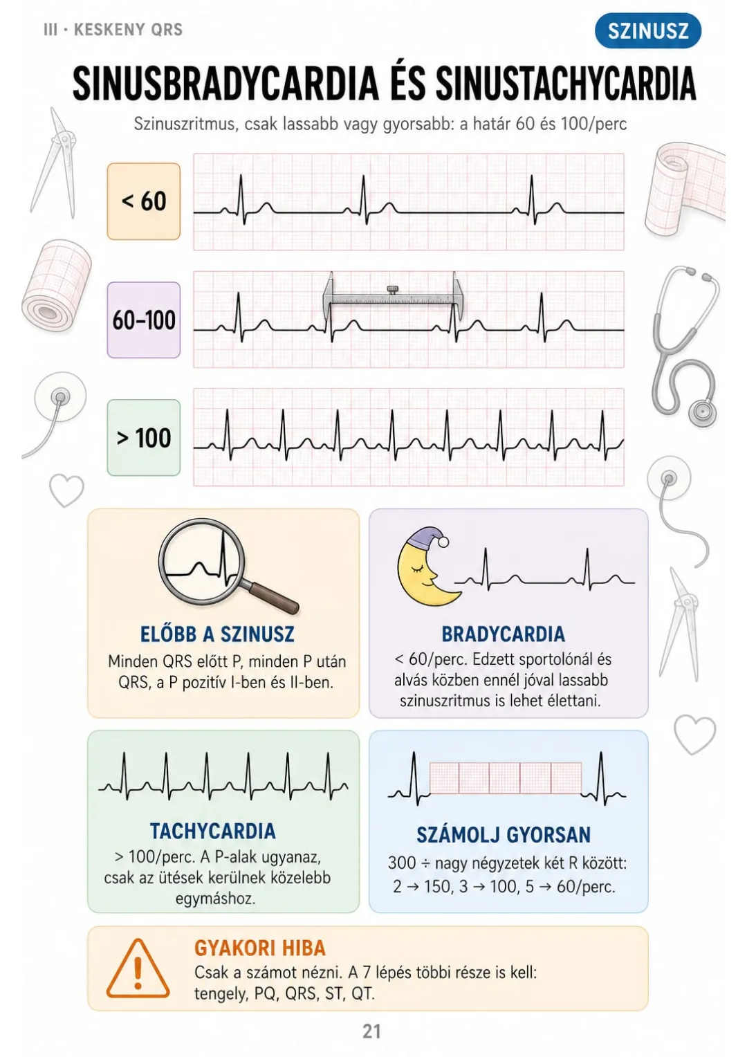 < 60/perc bradycardia, > 100/perc tachycardia – de előbb a P-hullám.
