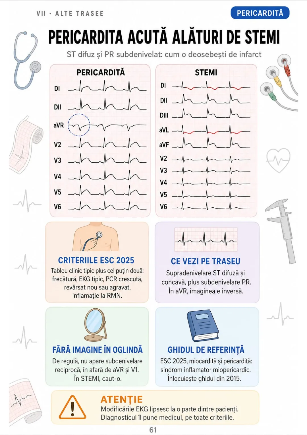 Pericardita acută: ST difuz concav, PR subdenivelat, aVR inversat; tablou clinic plus două criterii (ESC 2025).