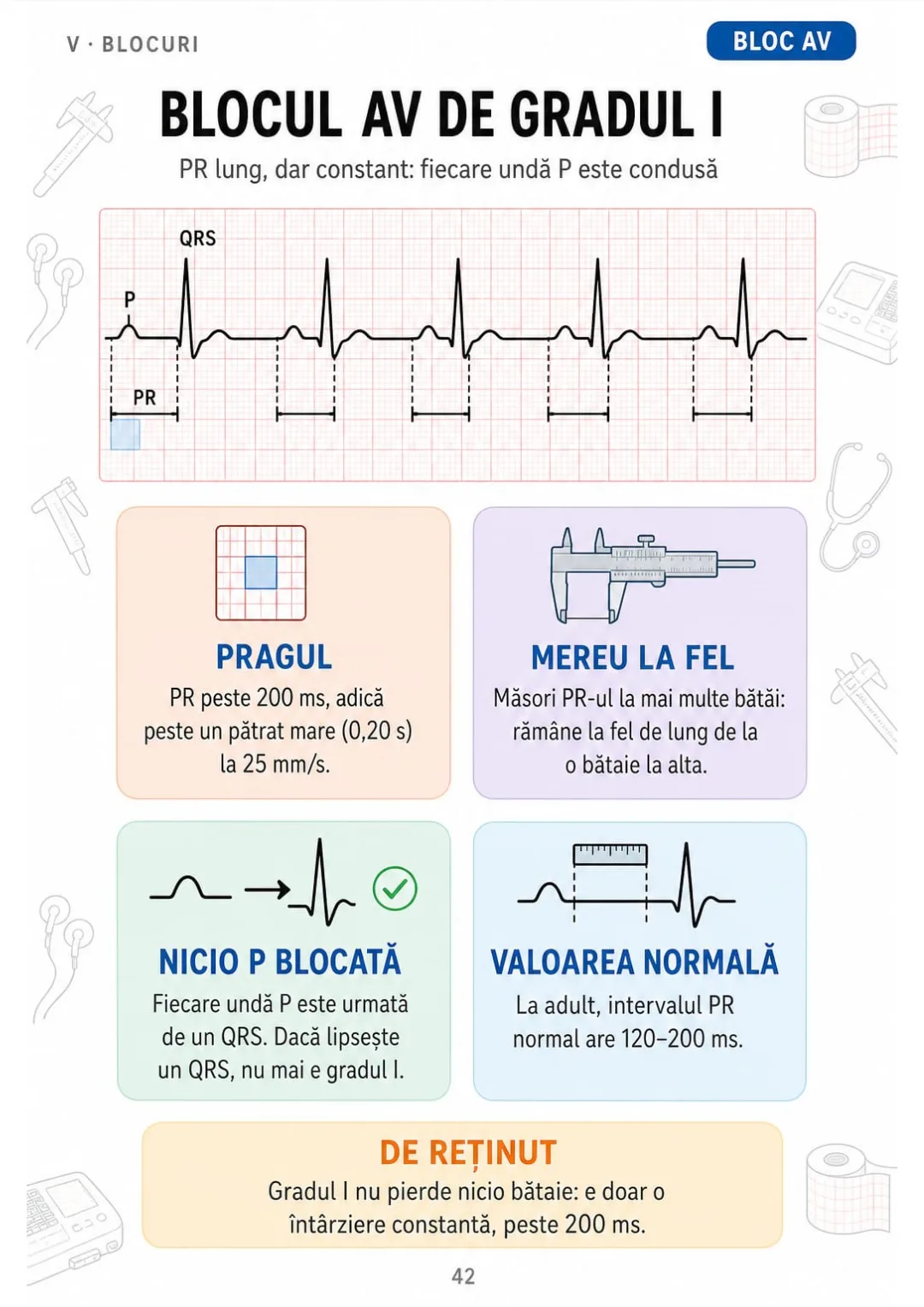 BAV gradul I: PR peste 200 ms, constant, fiecare P urmată de QRS.